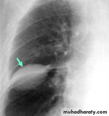 Chest investigations