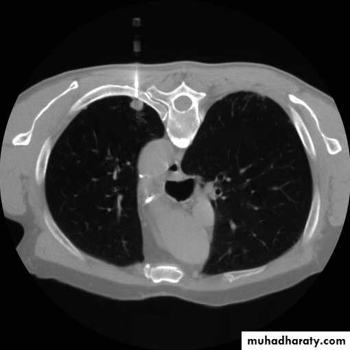 Chest investigations