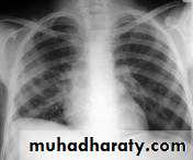 Chest investigations