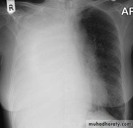 Chest investigations