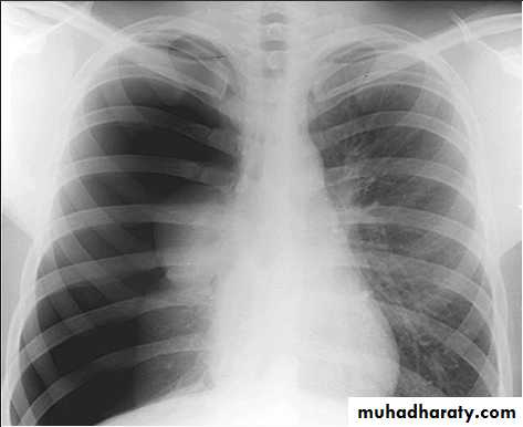 Chest investigations