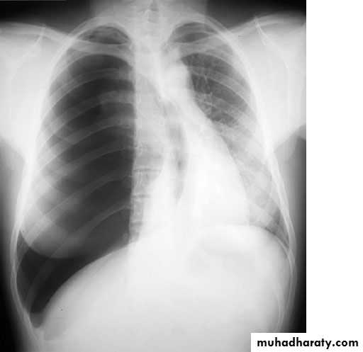 Chest investigations