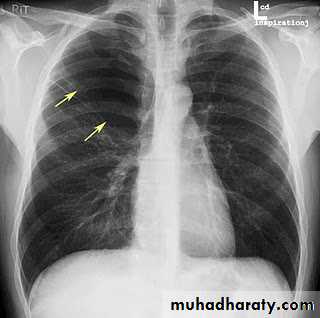 Chest investigations