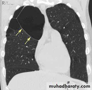 Chest investigations