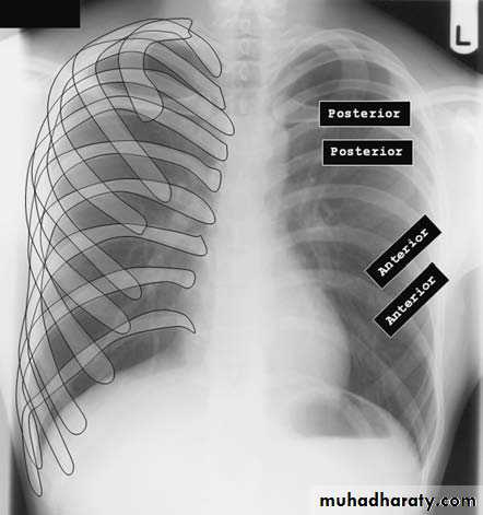 Chest investigations