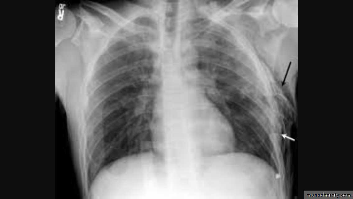 Chest investigations