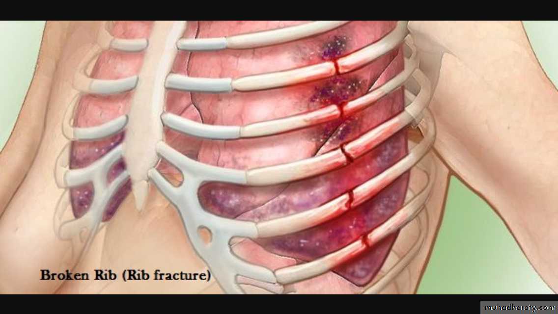 Chest investigations