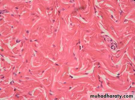 Connective tissue