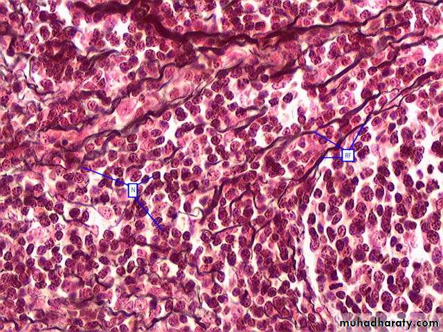 Connective tissue