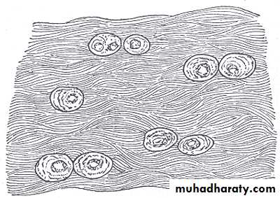 Connective tissue