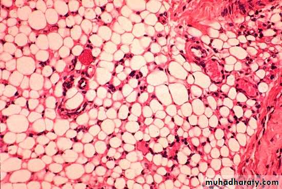 Connective tissue