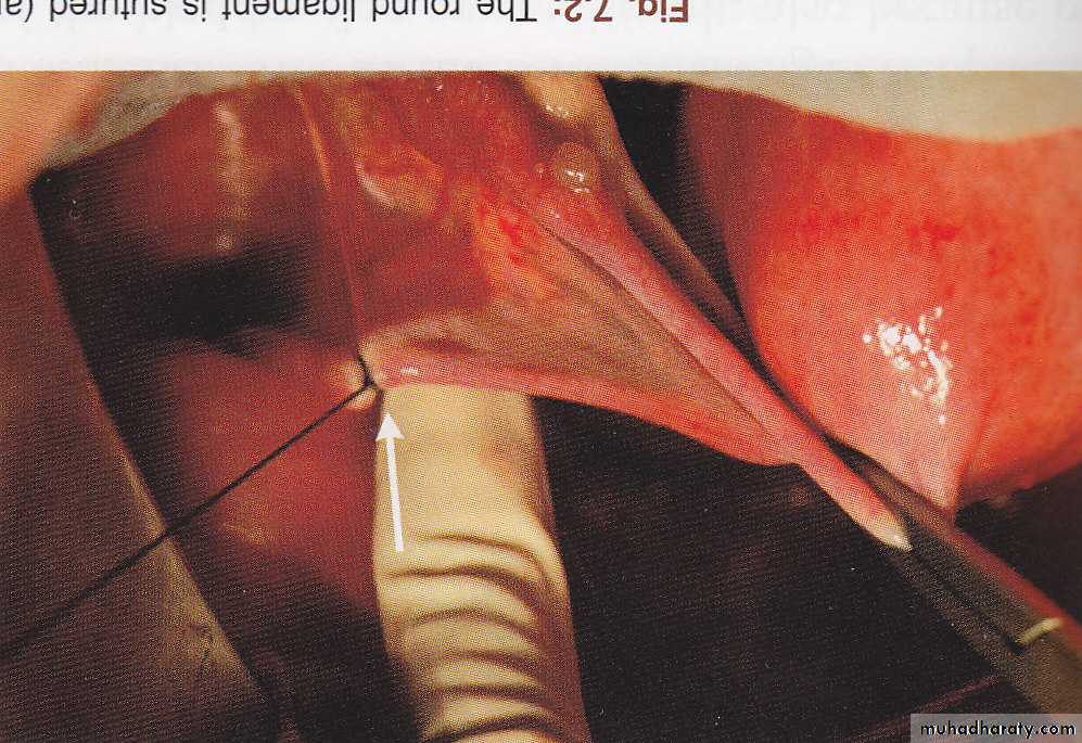 Anatomy of female reproductive system