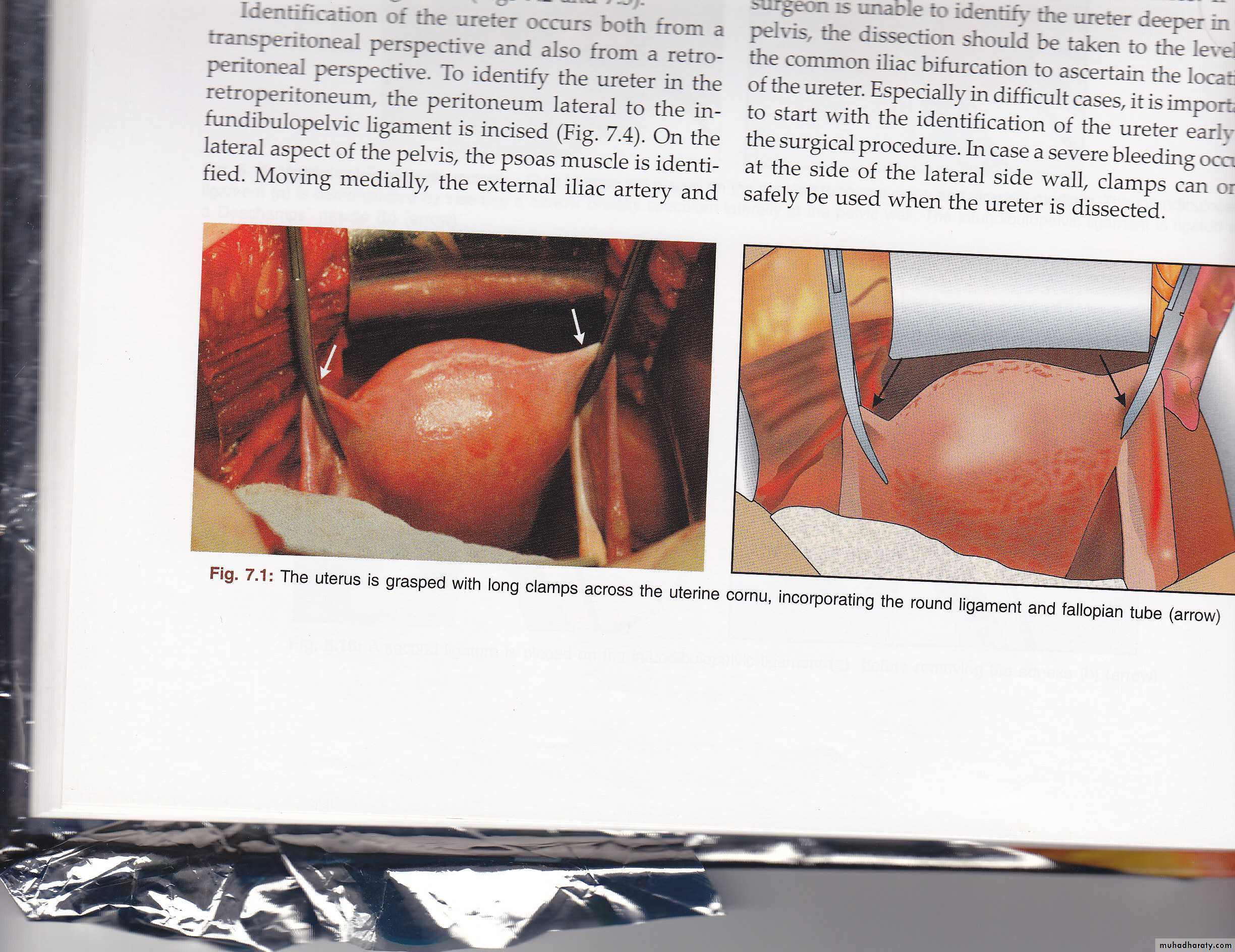 Anatomy of female reproductive system