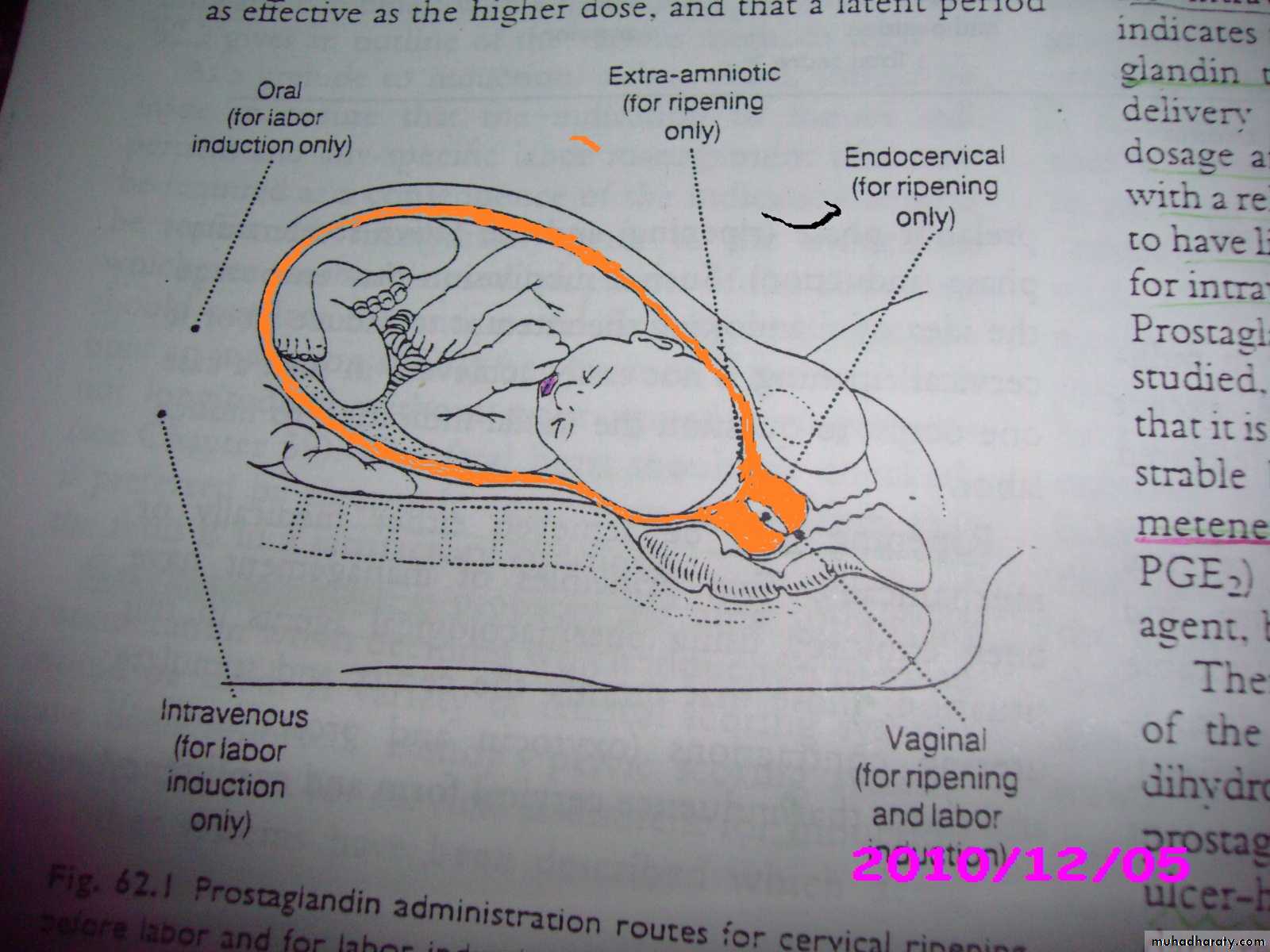 Anatomy of female reproductive system