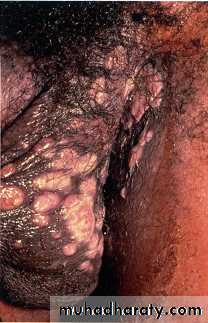 STD