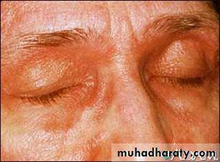 TUMOURS OF THE STOMACH