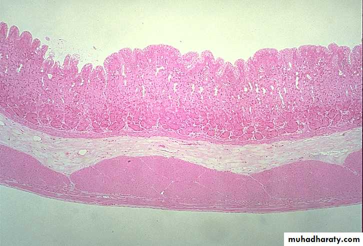 TUMOURS OF THE STOMACH