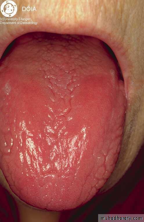 MALABSORPTION