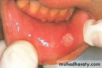 MALABSORPTION