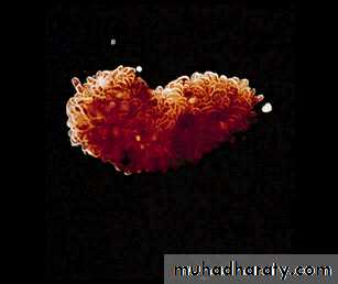 MALABSORPTION