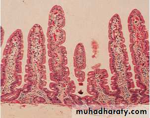 MALABSORPTION