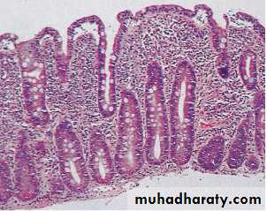 MALABSORPTION