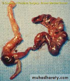 MALABSORPTION