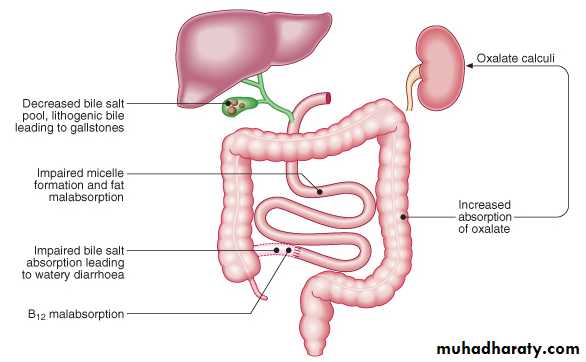 MALABSORPTION