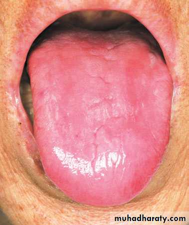 MALABSORPTION