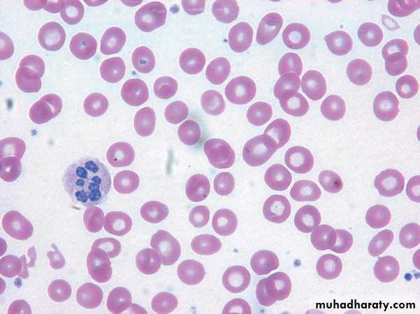 MALABSORPTION