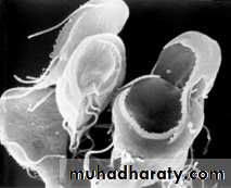 Giardiasis
