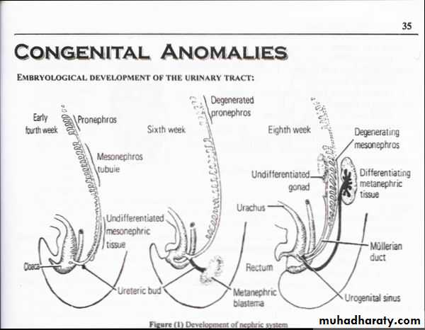 Congenital anomalies of upper ut