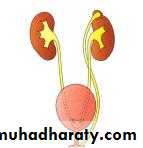Congenital anomalies of upper ut