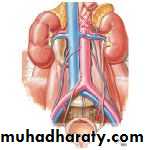 Congenital anomalies of upper ut