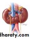 Congenital anomalies of upper ut