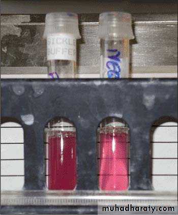 hemoglobinopathies