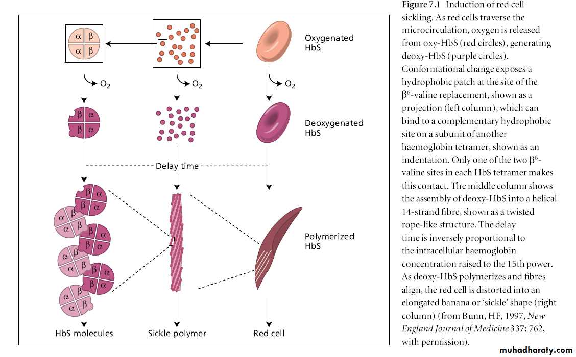 hemoglobinopathies