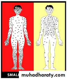 Chicken pox Herpes zoster