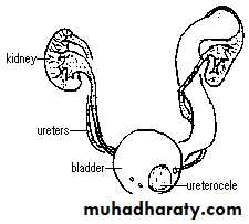 Renal surgical infections