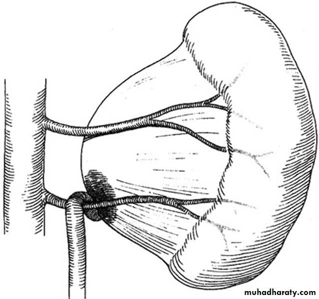 Renal surgical infections