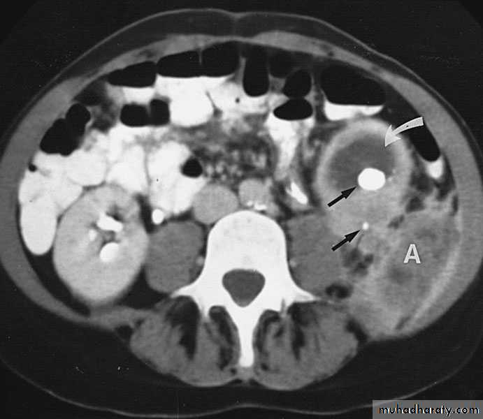 Renal surgical infections