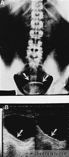 Renal surgical infections