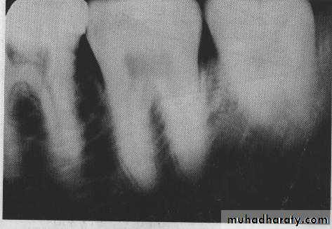 image characteristic