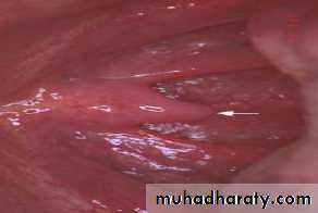 myology related to CD