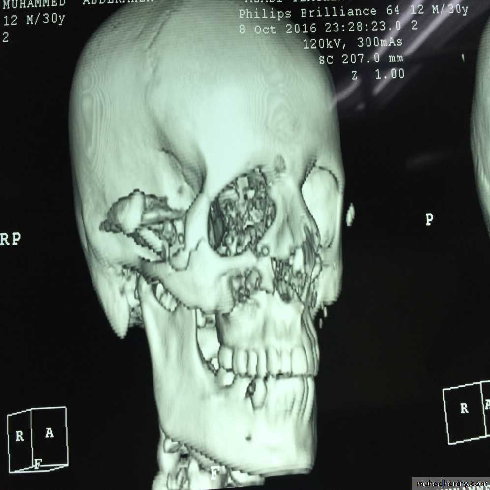 Human anatomy face