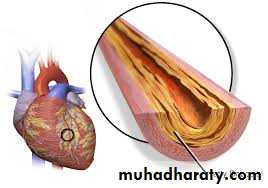 Ischemic Heart diseases