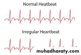 Heart failure