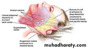 Parotid gland