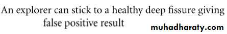caries diagnosis