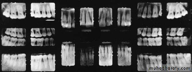 film processing